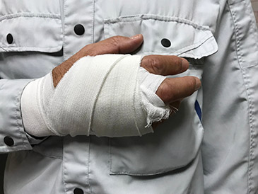 Partially at Fault for a Workplace Injury | California Employment Lawyers